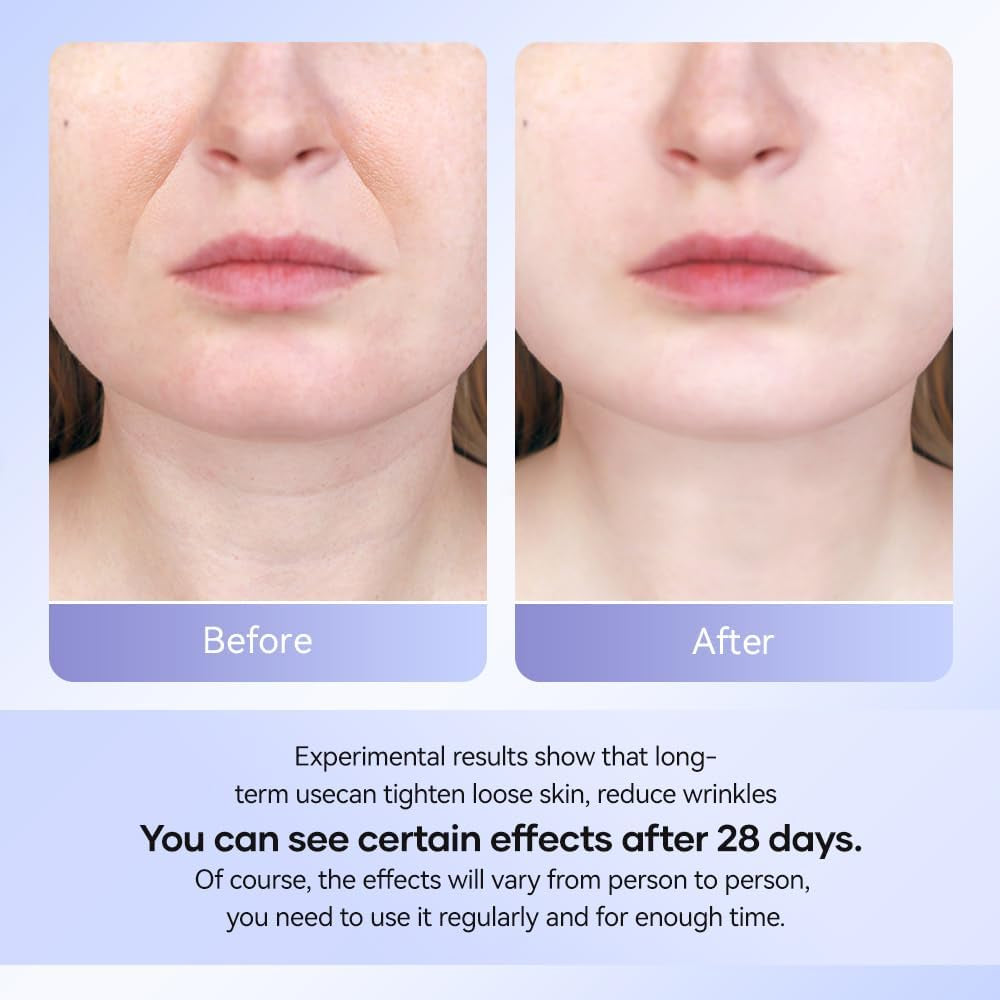 Face Massager, Anti-Wrinkle Face Device with 3 Modes 45°C for Skintightening & Neck Lifting EMS Massage Face Toning Firming for Women